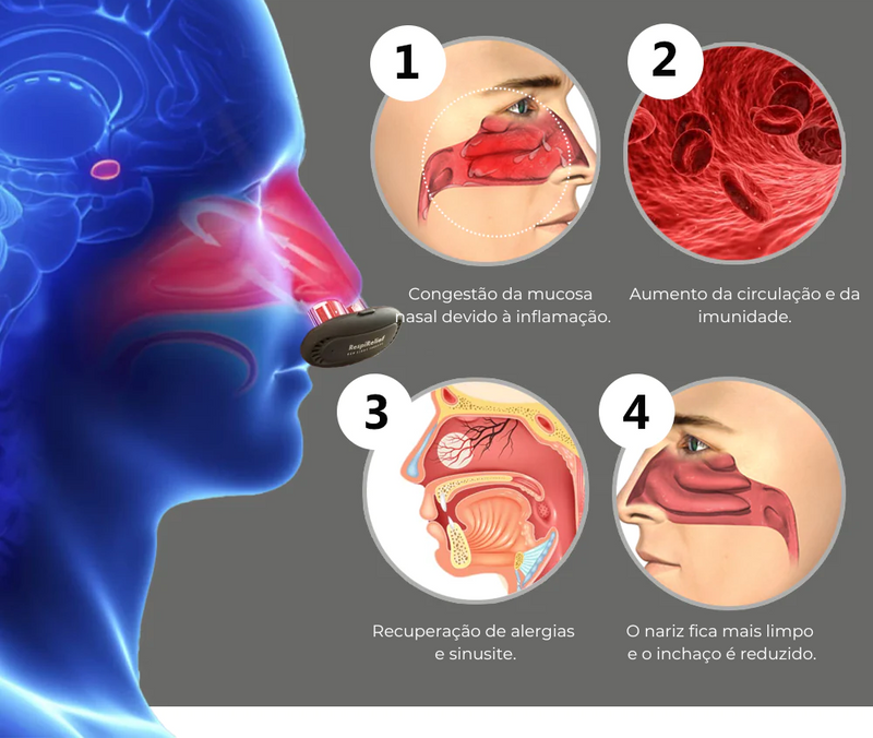 Dispositivo Terapia Nasal de Luz Vermelha RespiRelief™