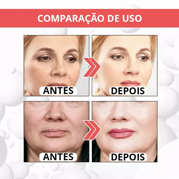 Botox UP - [TRATAMENTO DE MINUTOS] + 1 BRINDE EXCLUSIVO - Center Brasil