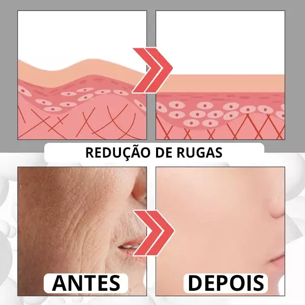 Botox UP - [TRATAMENTO DE MINUTOS] + 1 BRINDE EXCLUSIVO - Center Brasil